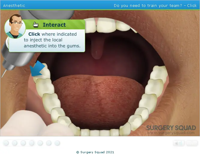 Surgery Squad: Virtual Erupted Wisdom Tooth Extraction