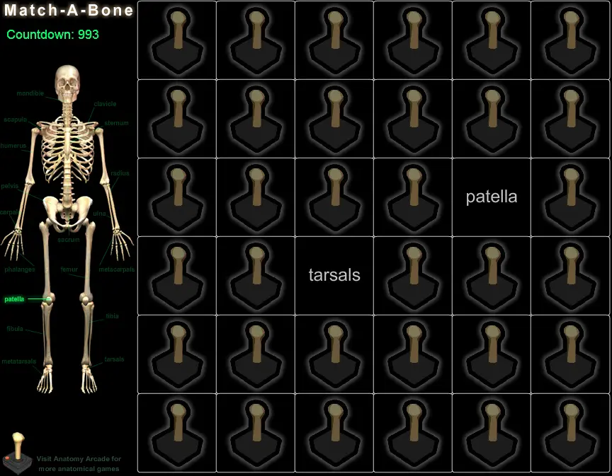 Match-A-Bone