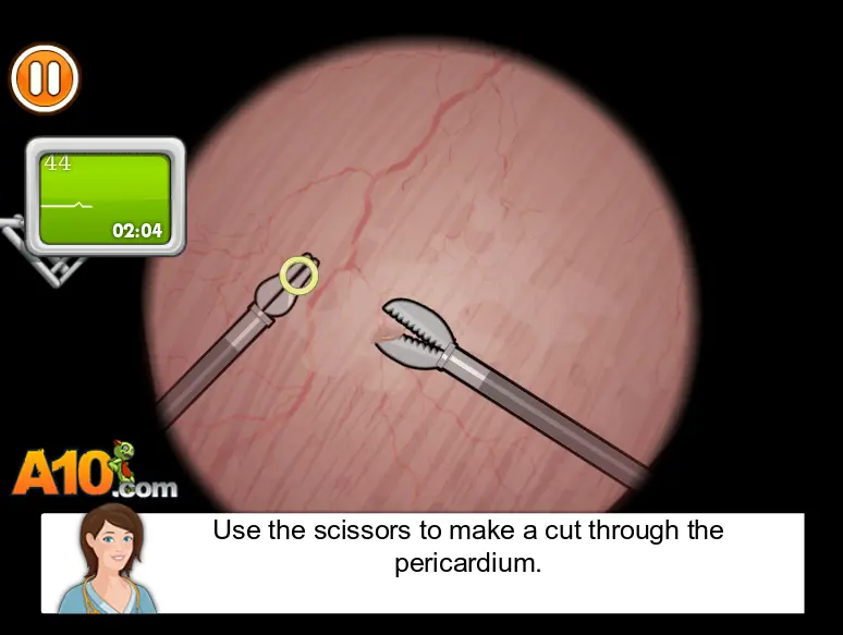 Operate Now! Pericardium Surgery