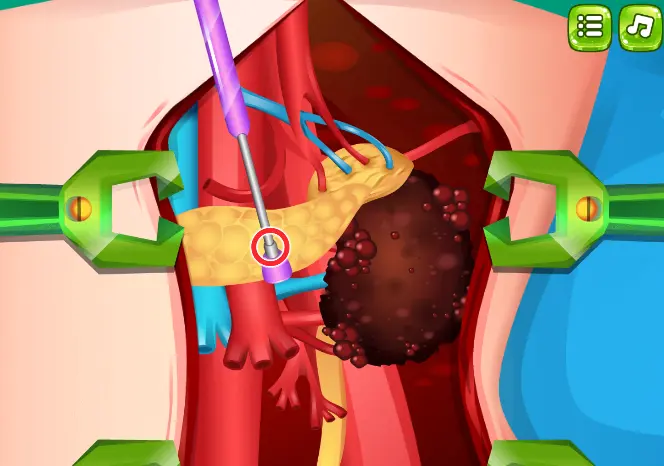 Princess Kidney Transplant