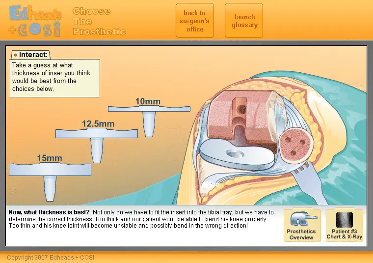 Choose the Prosthetic