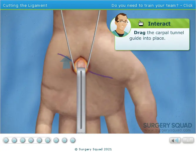 Surgery Squad: Limited Open Carpal Tunnel Release
