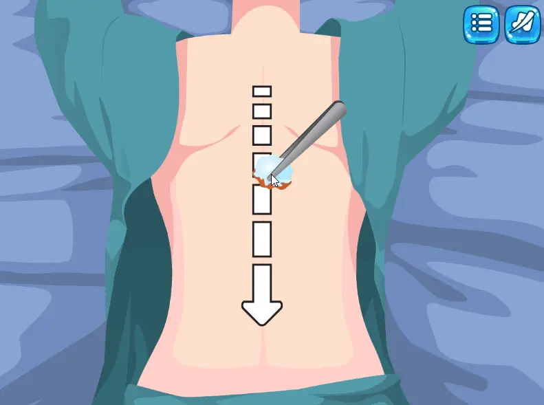 Princess Scoliosis Surgery